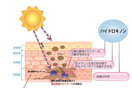 皮膚断面図
