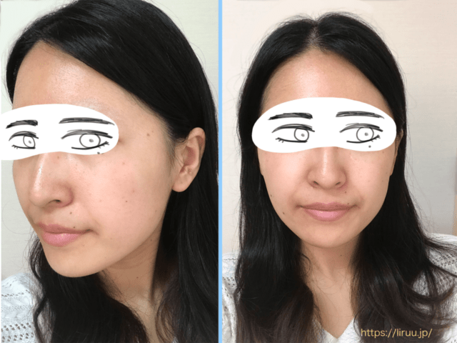 ディセンシア サエル をお試しレビュー 口コミ 成分 効果は Liruu